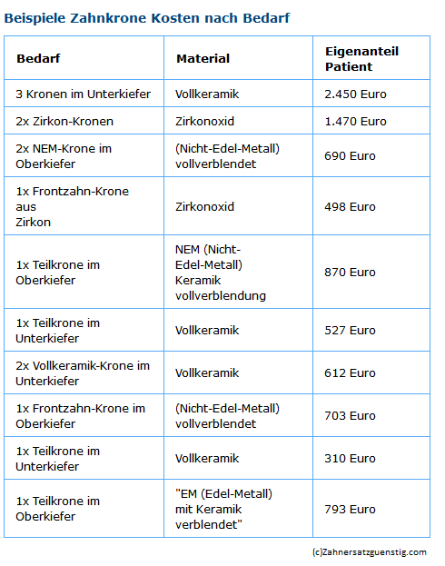 Zahnkrone Kosten